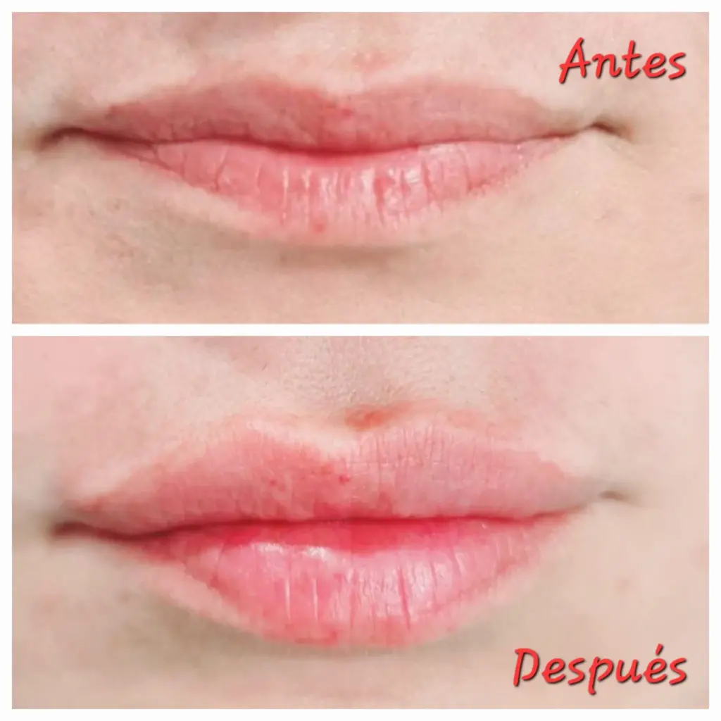 somos-los-mejores-Armonía-Aesthetic